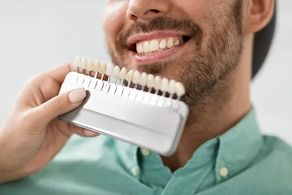 Close-up of a male patient's teeth being matched to a dental veneer shade guide during a consultation.